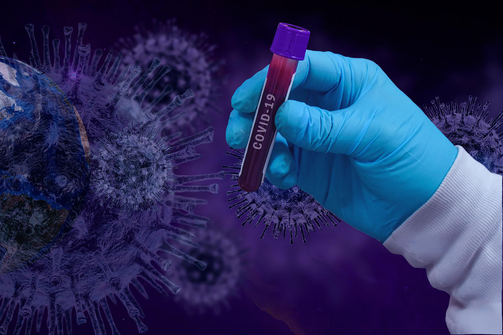 Zmiany epigenetyczne w komórkach krwi są kluczowe w ciężkości przebiegu infekcji SARS-CoV-2