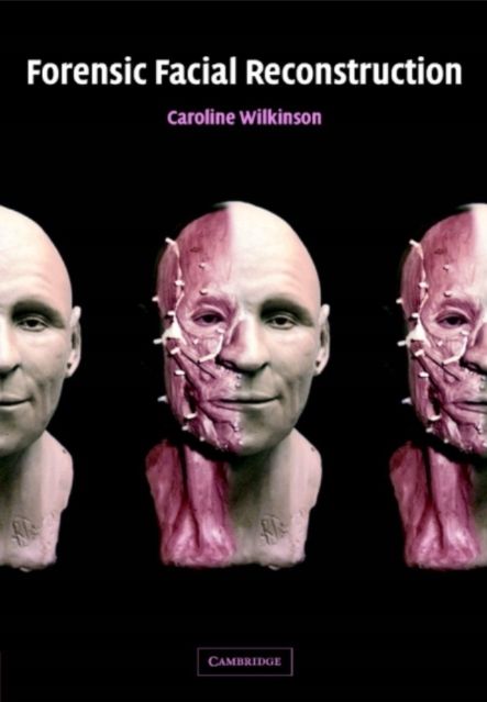 Forensic Facial Reconstruction