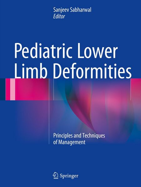 Link do książki online: Pediatric Lower Limb Deformities