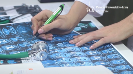 Wpływ czynników zapalnych na neuronalne korelanty osobowości chwiejnej emocjonalnie typu borderline.&nbsp; 