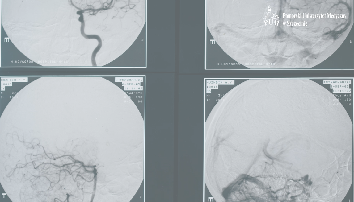 Porównanie strategii wzmożonego nadzoru mikrobiologicznego na poziomie molekularnym z profilaktyką przeciwinfekcyjną ceftriaksonem u pacjentów w trakcie transplantacji komórek krwiotwórczych.