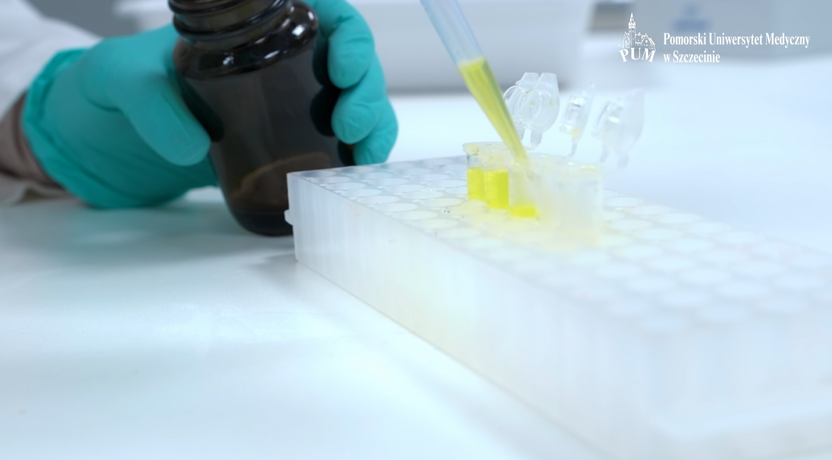 Wpływ wirusa BK na wirom i biomarkery odpowiedzi immunologicznej w moczu biorców nerki przeszczepionej