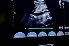 Warsztaty ultrasonograficzne z fundacją Mocni na stracie 