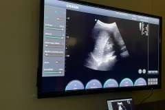 Warsztaty ultrasonograficzne z fundacją Mocni na stracie 