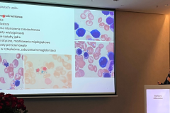 prelegentka wygłaszająca wykład, na ekranie wyświetla się prezentacja