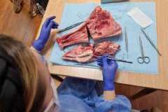 Minimalnie inwazyjne leczenie chirurgiczne