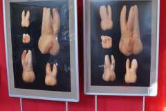 Zdążyć przed próchnicą