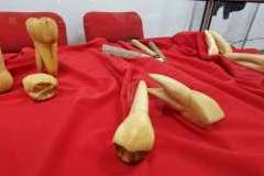 Zdążyć przed próchnicą