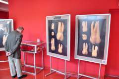 Zdążyć przed próchnicą